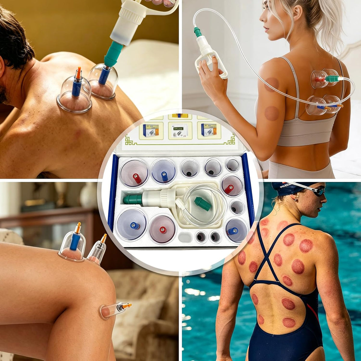 Cupping Therapy Set with Pump | 24-Cup Massage Therapy Kit